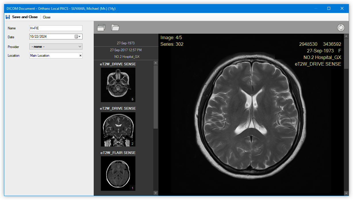 medical-documents-management-dicom-study-orthanc-brain