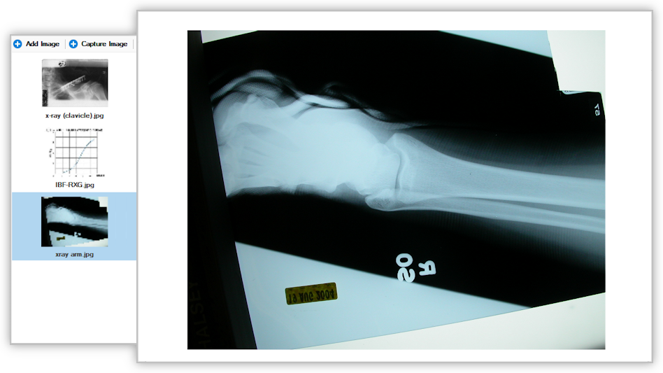 Link Images to Medical Records